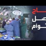 الرابعة | نجاح عملية فصل التوأم السوري في السعودية