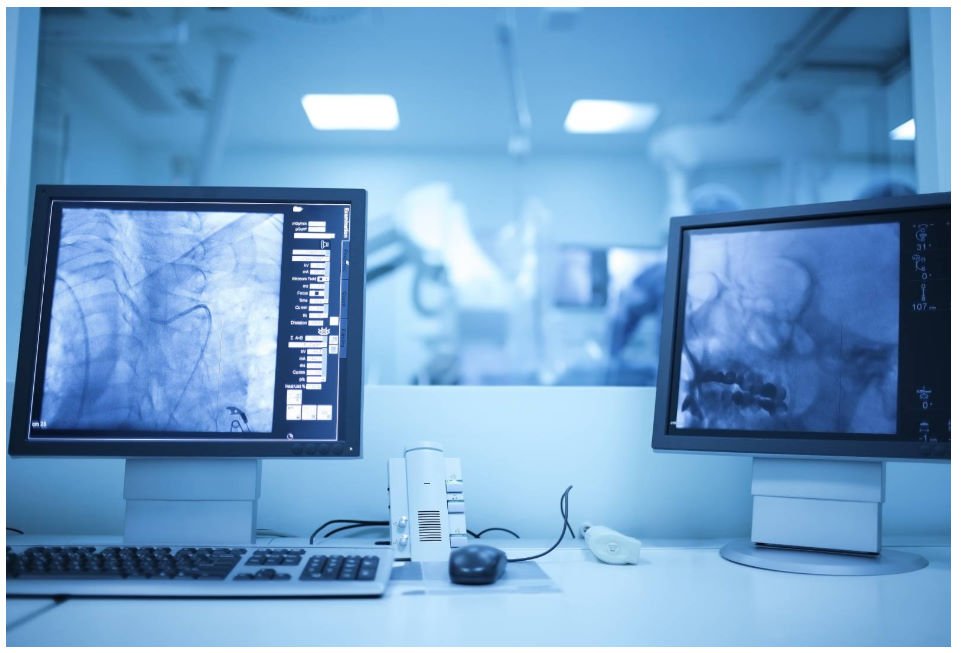 أفضل مركز أشعة تداخلية - د. أحمد سعفان